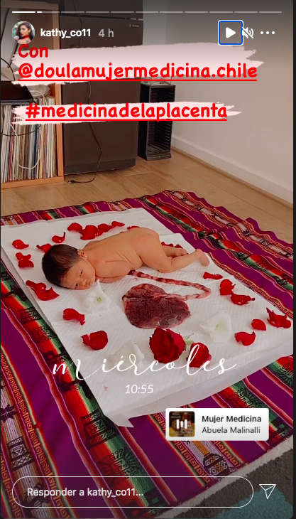 Kathy Contreras comparte foto de la placenta de su hija