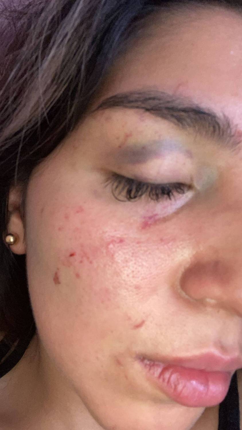 Mujer agredida por Naya Fácil pide 8 años de cárcel para la influencer