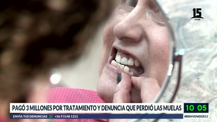 Mujer denuncia que negligencia dental le hizo perder sus muelas