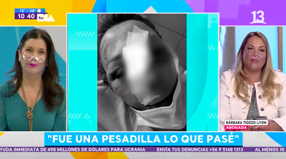 Ex integrante de “Mekano” fue brutalmente golpeada por arrendatarios