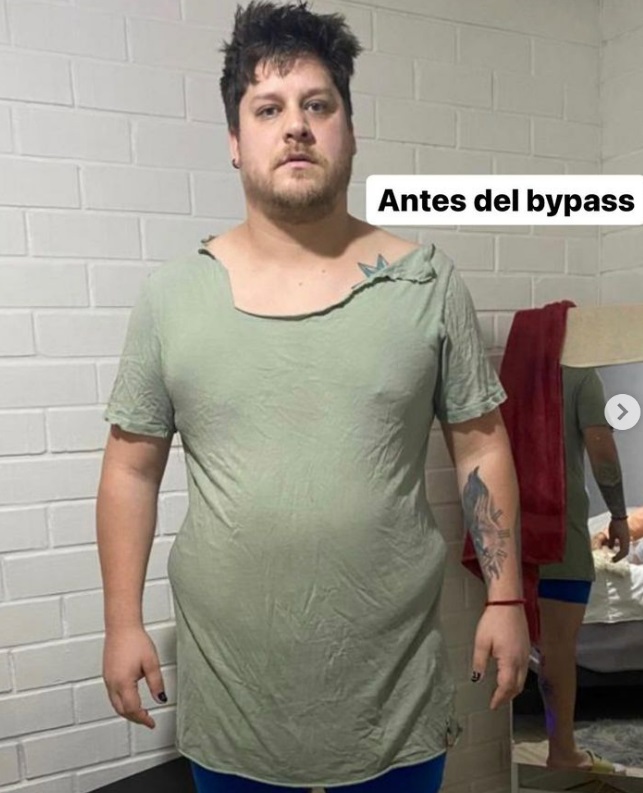 Elfi de “Yingo” impacta con foto de su extremo cambio físico