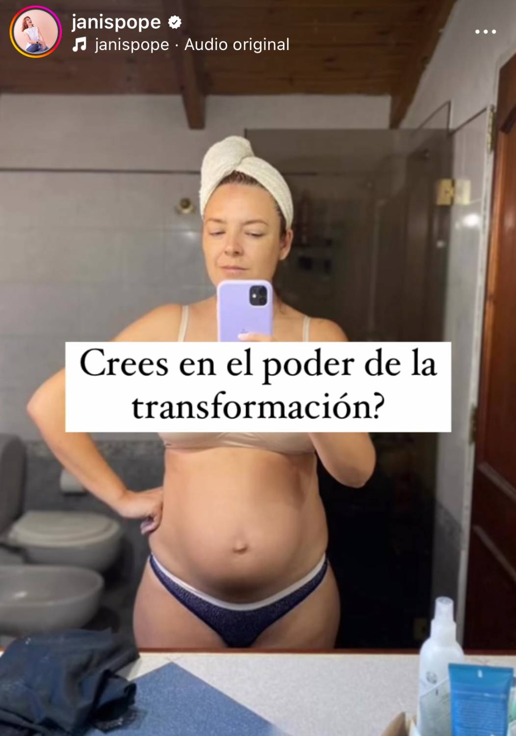 Janis Pope muestra el antes y después de su embarazo