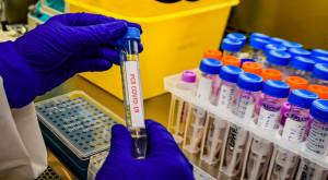 El innovador método de un investigador chileno para detectar pacientes con Covid-19 asintomático