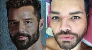 “Quedé más lindo que él”: Exchico reality se sometió a varias operaciones para ser Ricky Martin