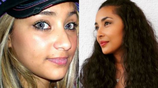 13 radicales “antes y después” de famosos chilenos
