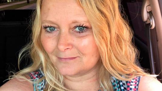 Mujer sufre tras hacerse microblading que arruinó sus cejas