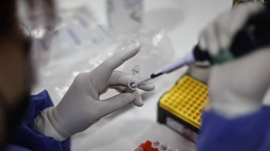 Segundo caso de viruela del mono confirmado en Chile: paciente es de la Región de la Araucanía