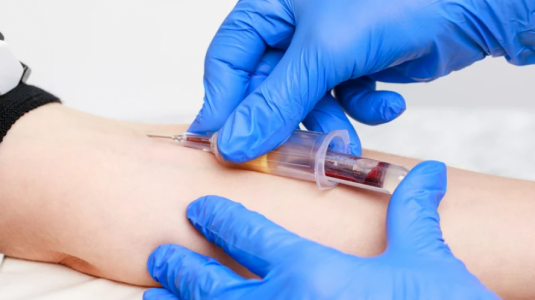 Examen de sangre