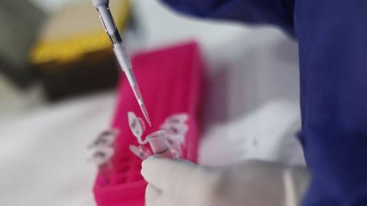 Viruela del mono en Chile: casos aumentan 95% en una semana